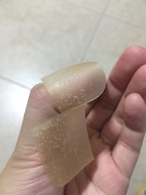 破皮了能贴痘痘贴