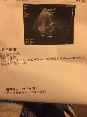 怀孕会出血嘛