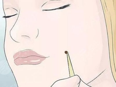 点痣挂什么号