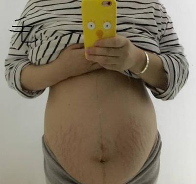4个月孕妇肚子有多大