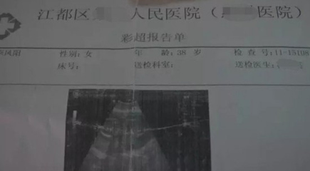 请问上环会怀孕吗