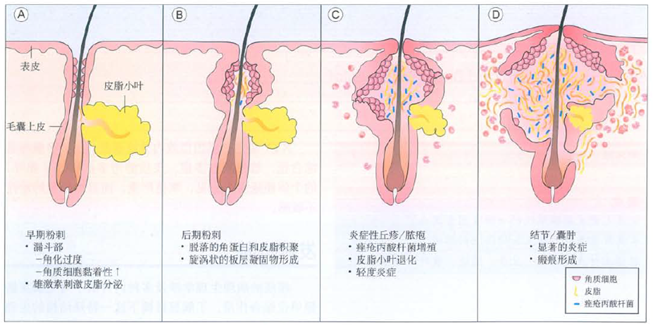 痘痘白头掉了之后