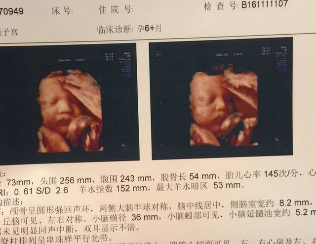 孕五个月胎动频繁正常吗