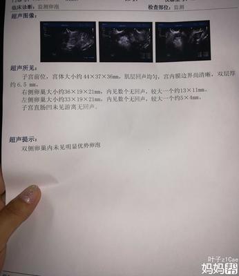 没有优势卵泡怎么治疗