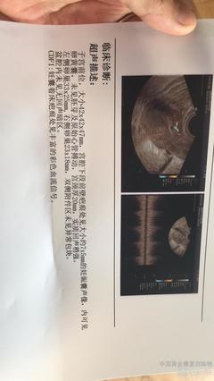 怀孕35天能看到孕囊吗