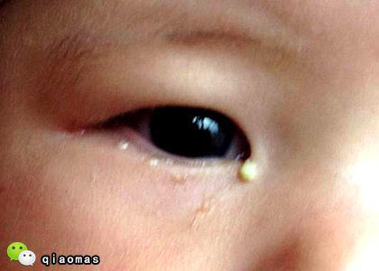 婴儿几个月能看见人