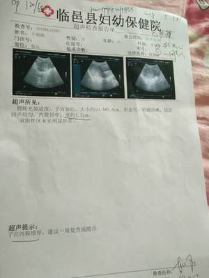 怀孕35天能看到孕囊吗