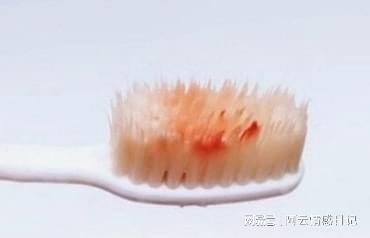 刷牙肚子疼是怎么回事