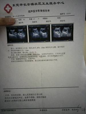 怀孕14周宝宝有多大
