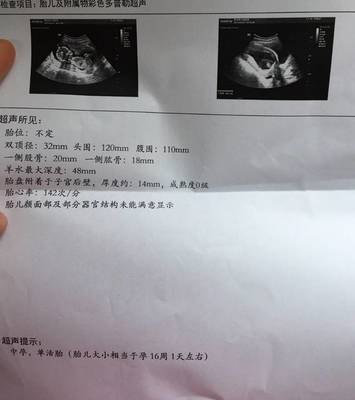 四个月双顶径多少正常