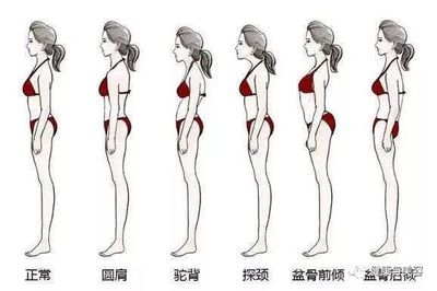 坐月子胯骨疼是怎么回事