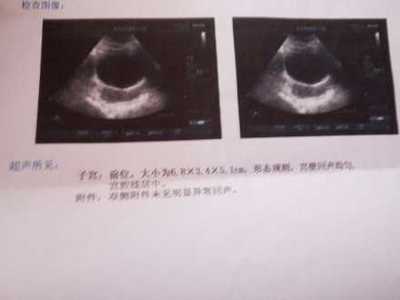 排卵期卵泡多大容易怀孕