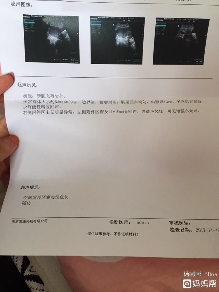 巧克力囊肿手术后多久可以怀孕
