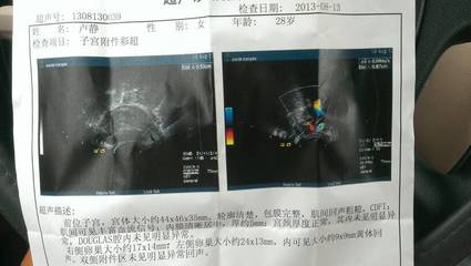 人流后三个月没来月经