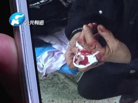 怀孕几天可以打掉孩子