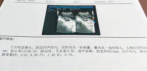 怀孕11周宝宝多大图片