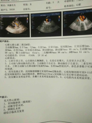 新生儿房缺做手术费用多少