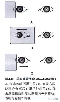 三棱镜100度是多少斜视