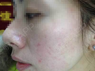 长春痘痘专注肤康