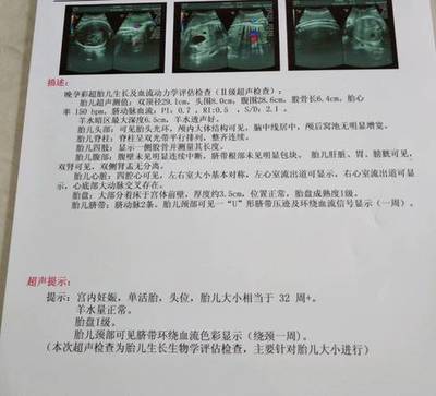 胎儿多少斤正常