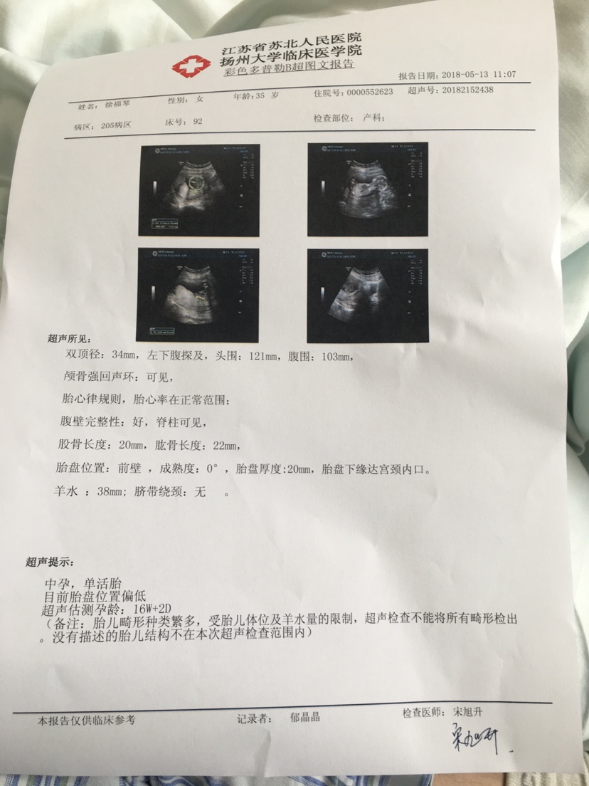 孕15周胎儿