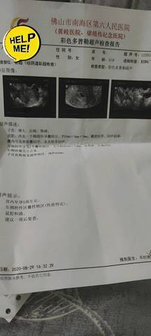 小腹隐隐作痛是怀孕吗