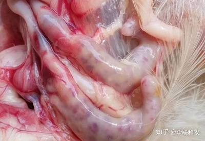 肠道淋巴结肿大是怎么回事