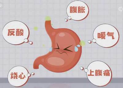 胃总感觉烧心是怎么回事