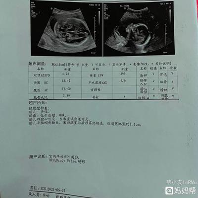 孕21周胎儿发育情况