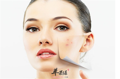 敏感肌肤痘痘发红