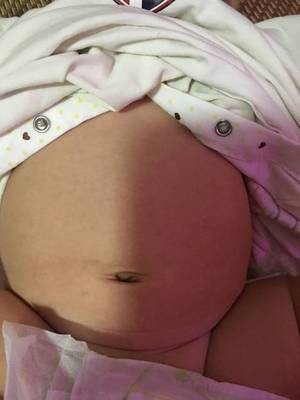 1岁宝宝肚子大正常吗