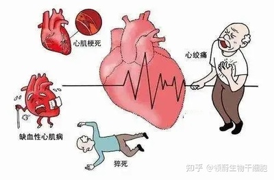 心机缺血是怎么回事