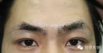脸型不对称面相
