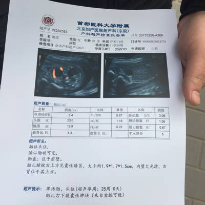怀孕25周胎儿有多大
