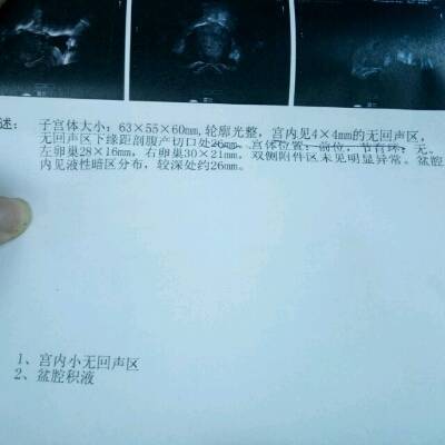 怀孕七个月能打胎吗