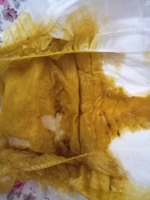 宝宝粑粑里有黑色颗粒