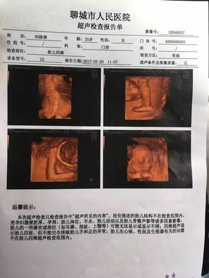 孕妇四维彩超图片