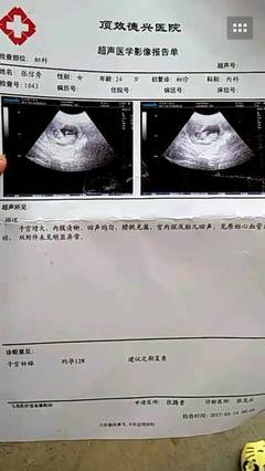 怀孕三个月宝宝