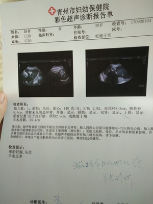 怀孕35周还有多久生产