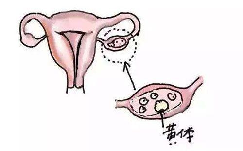 不是排卵期出血是怎么回事