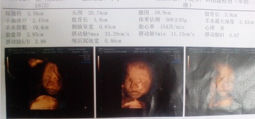 怀孕5个半月是多少周