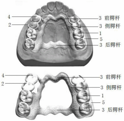 口腔义齿制造