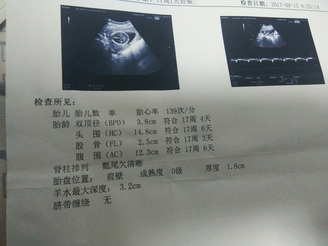 下胎大概需要多少钱