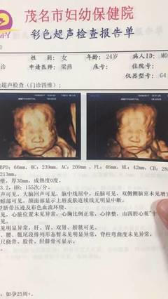 怀孕35天怀男孩症状