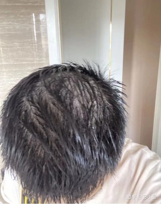 男生爱掉头发是怎么回事