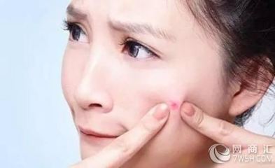 化妆长痘痘怎么办