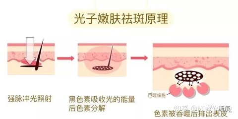 收缩毛孔的原理