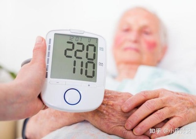 正常63岁女的血压多少钱