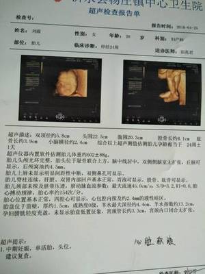 胎儿心包腔少量积液