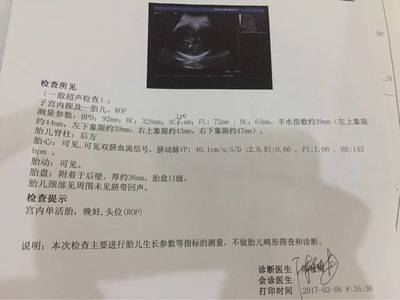 孕期腹围多少正常